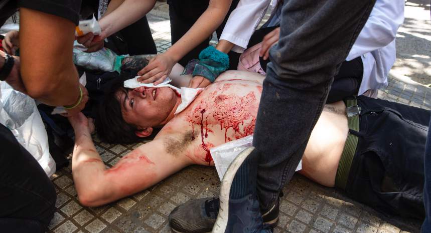 Mutilar manifestantes, disparándoles al rostro con escopetas es un crimen de la máxima crueldad