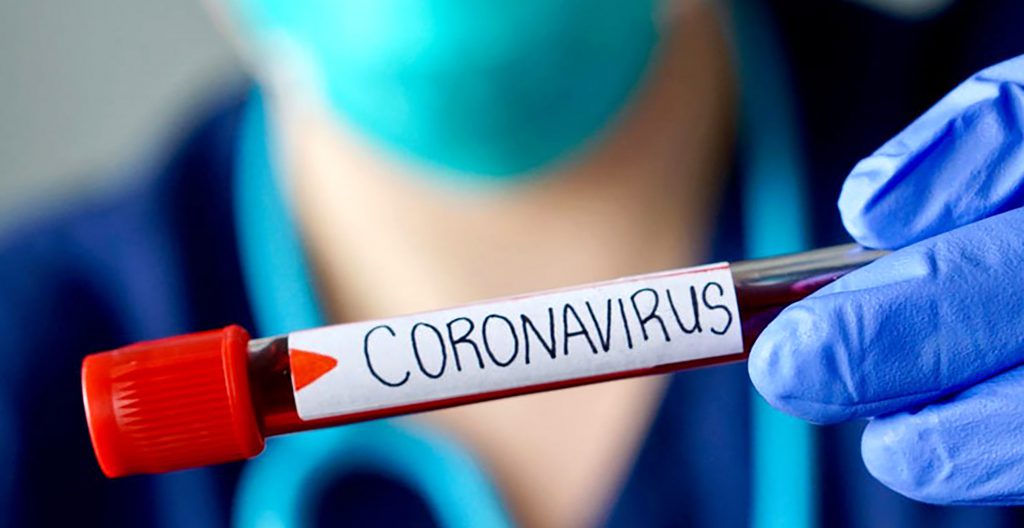 Expertos sostienen que cifra de nuevos casos por Coronavirus revela una insuficiente capacidad de testeo