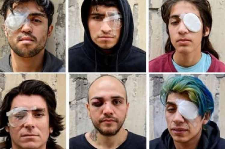 Víctimas chilenas de trauma ocular critican haber sido abandonadas