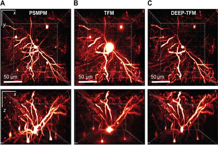 Nuevo sistema de imagen impulsará investigaciones en neurociencias
