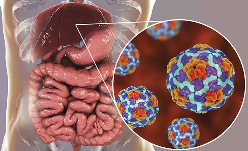 Muertes por hepatitis viral aumenta en el mundo